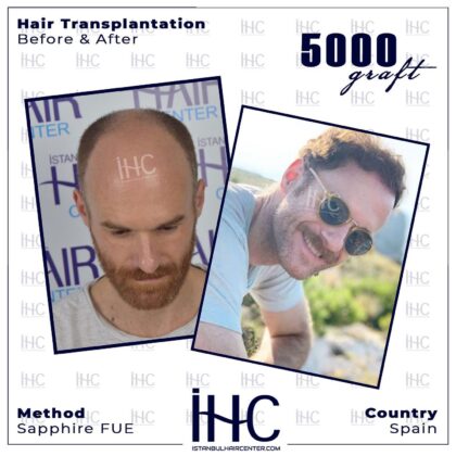 İstanbul Hair Center