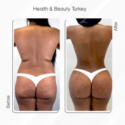 Health & Beauty Turkey Clinic