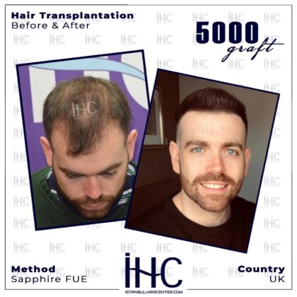 İstanbul Hair Center