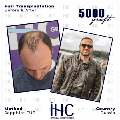 İstanbul Hair Center