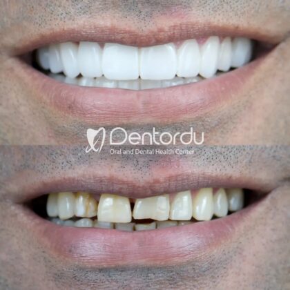 DentOrdu Oral and Dental Health Center