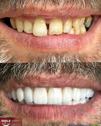 Yalova Dental Park