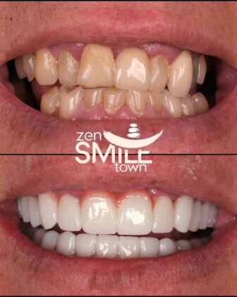 ZenSmile Town Clinic