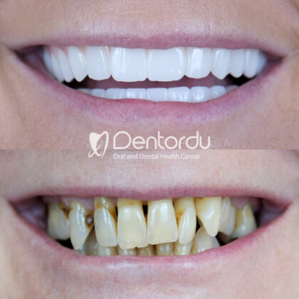 DentOrdu Oral and Dental Health Center