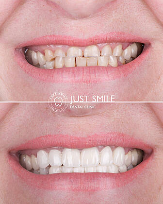 Just Smile Dental Clinic