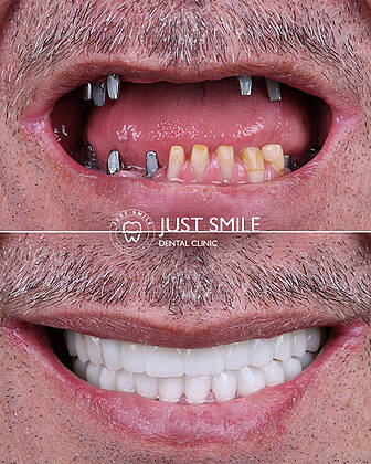Just Smile Dental Clinic
