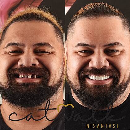 Catwalk Nişantaşı Dental Clinic