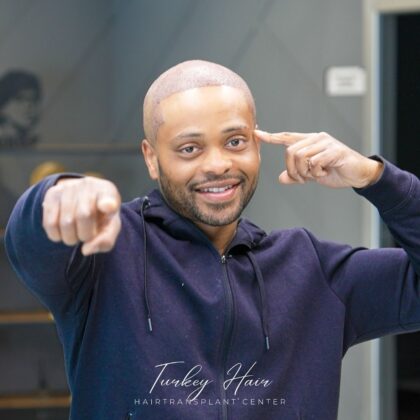 Turkey Hair Transplant Center Turkey Hair Transplant Center