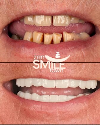 ZenSmile Town Clinic