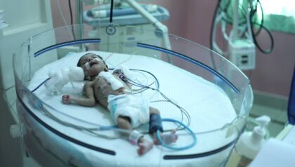 CARE Hospitals, Hi-Tech City