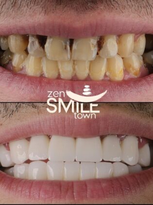 ZenSmile Town Clinic