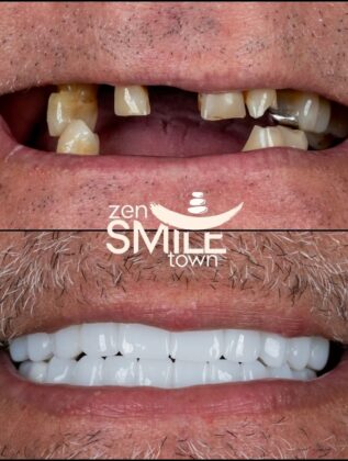 ZenSmile Town Clinic