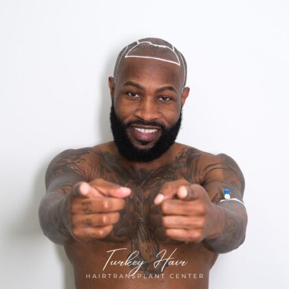 Turkey Hair Transplant Center Turkey Hair Transplant Center