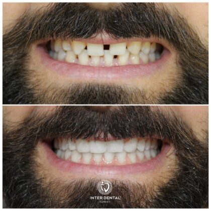 Inter Dental Turkey