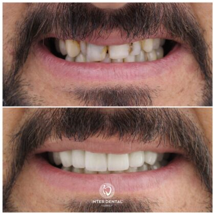 Inter Dental Turkey