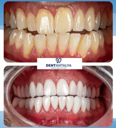 DentAntalya Private Oral and Dental Health Clinic