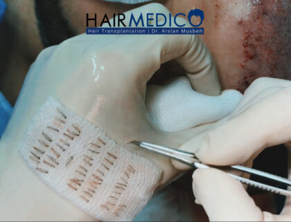 Hairmedico