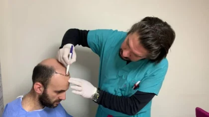 Dr. Ziya Yavuz Hair Transplant Clinic