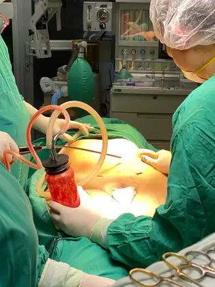 Universal Plastic Surgery Universal Plastic Surgery