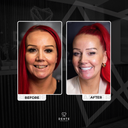 Dente Dental Studio