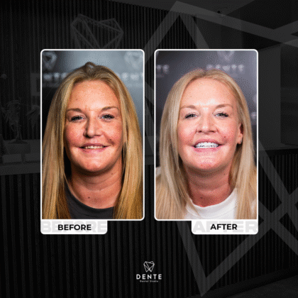 Dente Dental Studio