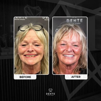 Dente Dental Studio