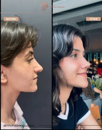 Prof. Dr. Murat Songu Clinic