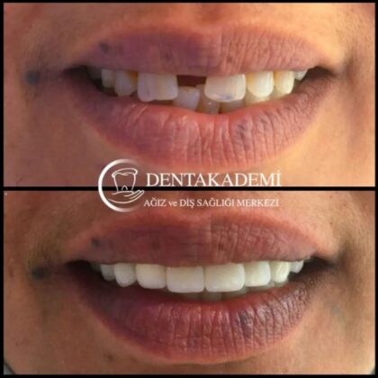 Dentakademi Oral and Dental Healthcare Center