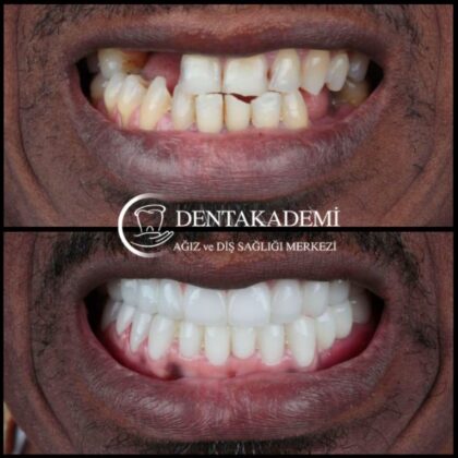 Dentakademi Oral and Dental Healthcare Center