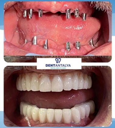 DentAntalya Private Oral and Dental Health Clinic