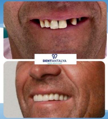 DentAntalya Private Oral and Dental Health Clinic