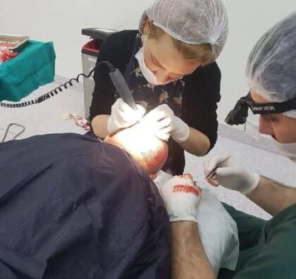 Clinista Hair Transplant Center Clinista Hair Transplant Center