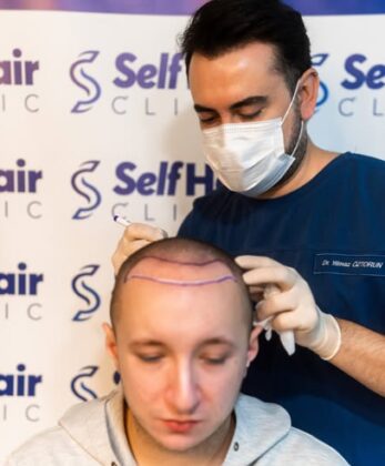 Self Hair Clinic