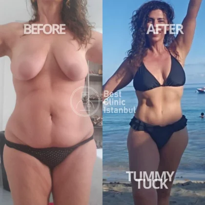 Best Clinic Istanbul