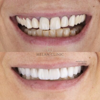 Melan Clinic