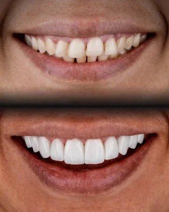Uzmanlar Dental Clinic