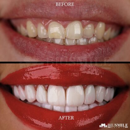 Biusmile Clinic