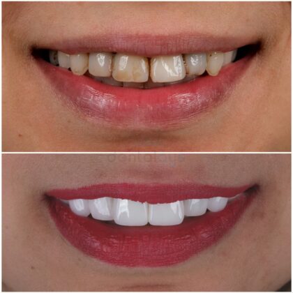 Dentalays Clinic Turkey