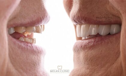 Melan Clinic