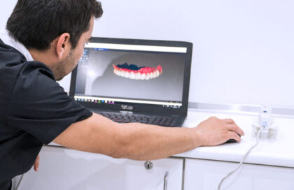 Propdental