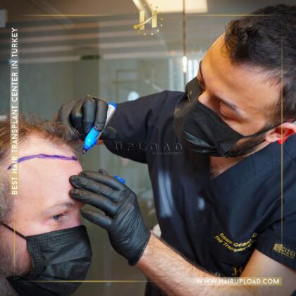 Hair Upload Hair Transplant Clinic