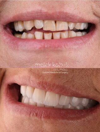 Melan Clinic