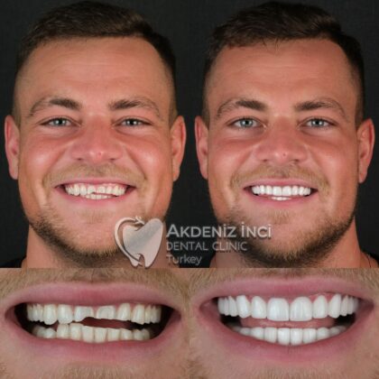 Akdeniz İnci Dental Clinic