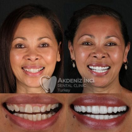 Akdeniz İnci Dental Clinic