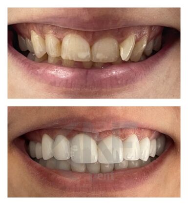 Nifa Dent International