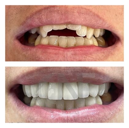 Nifa Dent International