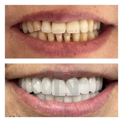 Nifa Dent International