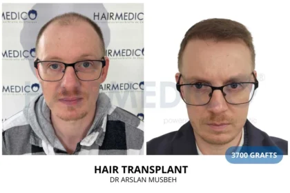 Hairmedico