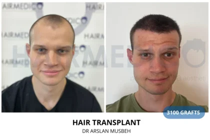Hairmedico
