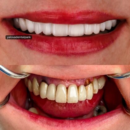 Yalova Dental Park